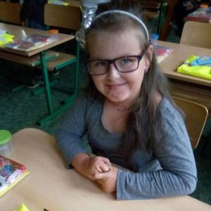 Péče o&nbsp;kůži zabere až 3 hodiny denně – příběh Terezky