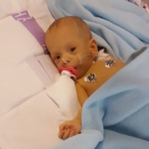 Čekání na to, až začnou dcerky dýchat samy, bylo nekonečné – rozhovor s paní Michaelou, 1. část