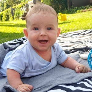 Denně stráví až 2 hodiny péčí o kůži – sedmiměsíční Mareček se potýká s ichtyózou