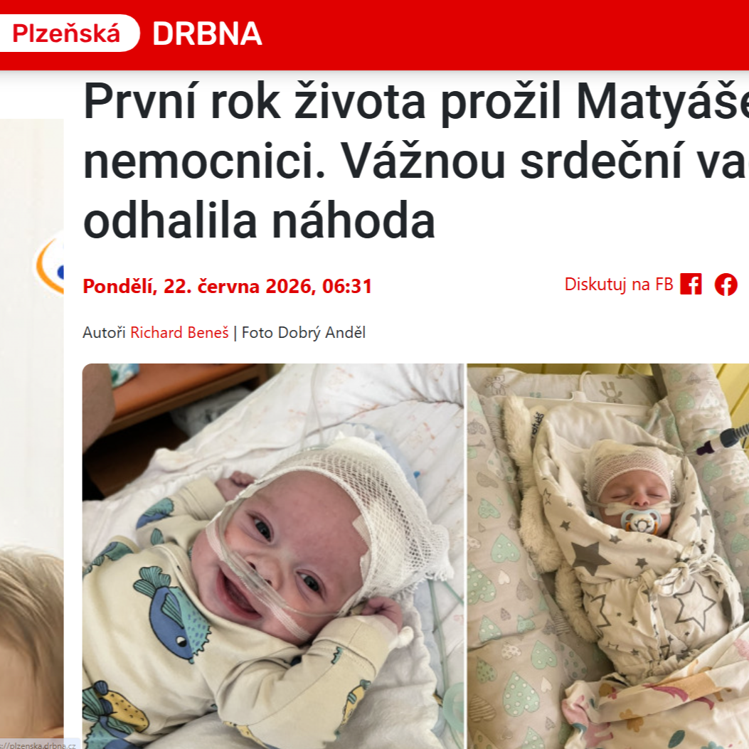 Plzeňská Drbna